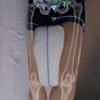 ALMOHADA ORTOPEDICA ENTRE PIERNAS